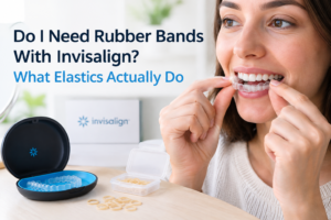 do i need rubber bands with invisalighn
